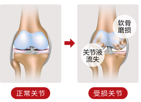 维骨力怎么吃好呢？-第1张图片-破壁灵芝孢子粉研究指南