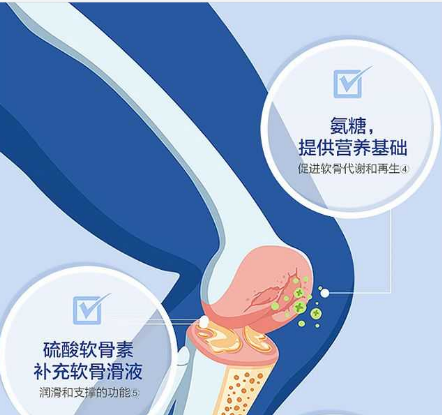 氨糖软骨素对关节炎有用吗?现在知道也不晚-第2张图片-破壁灵芝孢子粉研究指南