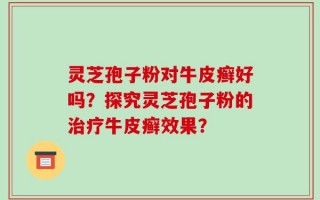 灵芝孢子粉对牛皮癣好吗？探究灵芝孢子粉的治疗牛皮癣效果？