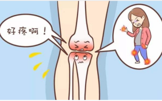 氨糖软骨素对关节炎的作用，45岁后的女性更需知道