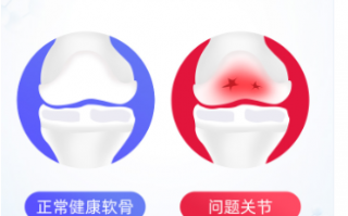 氨糖软骨素钙片的作用与功效普及！