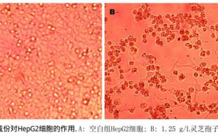 灵芝孢子粉对人肝癌细胞HepG2及裸鼠移植瘤生长的抑制作用