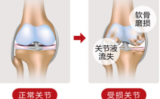 哪些人不能服用氨糖维骨力呢？
