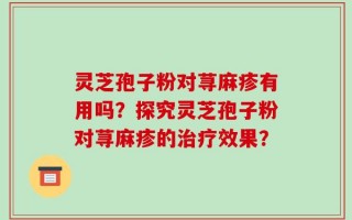 灵芝孢子粉对荨麻疹有用吗？探究灵芝孢子粉对荨麻疹的治疗效果？