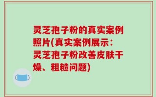 灵芝孢子粉的真实案例照片(真实案例展示：灵芝孢子粉改善皮肤干燥、粗糙问题)