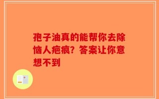 孢子油真的能帮你去除恼人疤痕？答案让你意想不到