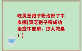 吃灵芝孢子粉治好了牛皮癣(灵芝孢子粉成功治愈牛皮癣，惊人效果！)