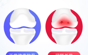 维力维氨糖软骨素爸爸一直在吃！