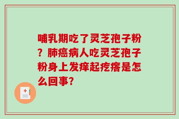 哺乳期吃了灵芝孢子粉?肺癌病人吃灵芝孢子粉身上发痒起疙瘩是怎么回事?-第1张图片-破壁灵芝孢子粉研究指南 哺乳期吃了灵芝孢子粉?肺癌病人吃灵芝孢子粉身上发痒起疙瘩是怎么回事?-第1张图片-破壁灵芝孢子粉研究指南