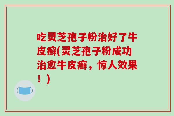 吃灵芝孢子粉治好了牛皮癣(灵芝孢子粉成功治愈牛皮癣,惊人效果!)-第1张图片-破壁灵芝孢子粉研究指南 吃灵芝孢子粉治好了牛皮癣(灵芝孢子粉成功治愈牛皮癣,惊人效果!)-第1张图片-破壁灵芝孢子粉研究指南
