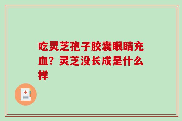 吃灵芝孢子胶囊眼睛充血?灵芝没长成是什么样-第1张图片-破壁灵芝孢子粉研究指南 吃灵芝孢子胶囊眼睛充血?灵芝没长成是什么样-第1张图片-破壁灵芝孢子粉研究指南