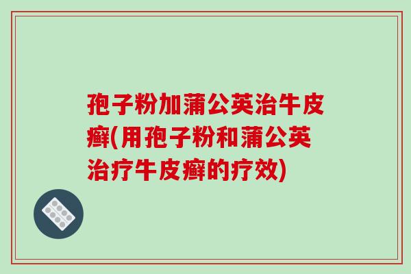 孢子粉加蒲公英治牛皮癣(用孢子粉和蒲公英治疗牛皮癣的疗效)-第1张图片-破壁灵芝孢子粉研究指南