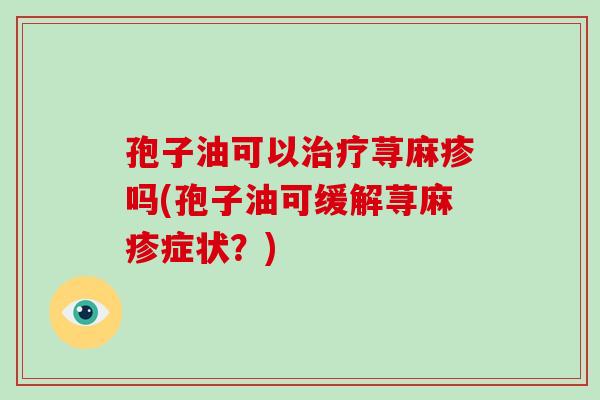孢子油可以治疗荨麻疹吗(孢子油可缓解荨麻疹症状？)-第1张图片-破壁灵芝孢子粉研究指南