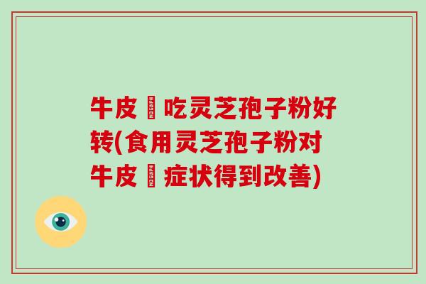牛皮癬吃灵芝孢子粉好转(食用灵芝孢子粉对牛皮癬症状得到改善)-第1张图片-破壁灵芝孢子粉研究指南 牛皮癬吃灵芝孢子粉好转(食用灵芝孢子粉对牛皮癬症状得到改善)-第1张图片-破壁灵芝孢子粉研究指南