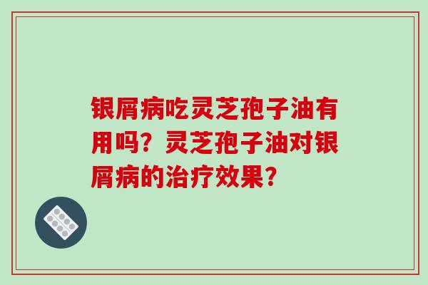 银屑病吃灵芝孢子油有用吗？灵芝孢子油对银屑病的治疗效果？-第1张图片-破壁灵芝孢子粉研究指南