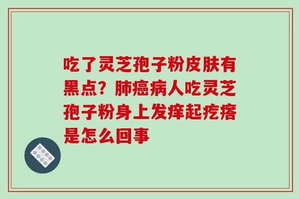 吃了灵芝孢子粉皮肤有黑点?肺癌病人吃灵芝孢子粉身上发痒起疙瘩是怎么回事-第1张图片-破壁灵芝孢子粉研究指南 吃了灵芝孢子粉皮肤有黑点?肺癌病人吃灵芝孢子粉身上发痒起疙瘩是怎么回事-第1张图片-破壁灵芝孢子粉研究指南
