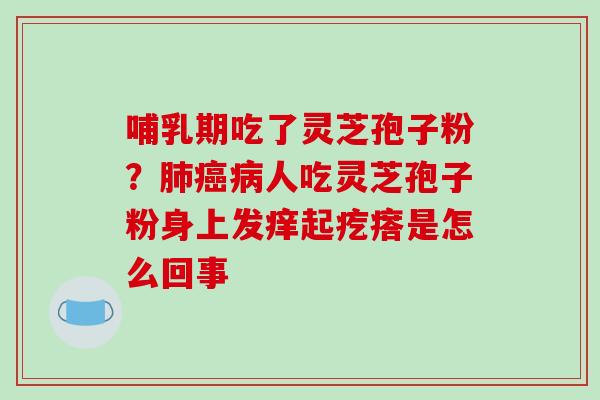 哺乳期吃了灵芝孢子粉?肺癌病人吃灵芝孢子粉身上发痒起疙瘩是怎么回事-第1张图片-破壁灵芝孢子粉研究指南 哺乳期吃了灵芝孢子粉?肺癌病人吃灵芝孢子粉身上发痒起疙瘩是怎么回事-第1张图片-破壁灵芝孢子粉研究指南