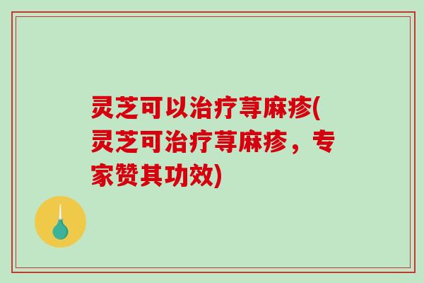 灵芝可以治疗荨麻疹(灵芝可治疗荨麻疹,专家赞其功效)-第1张图片-破壁灵芝孢子粉研究指南 灵芝可以治疗荨麻疹(灵芝可治疗荨麻疹,专家赞其功效)-第1张图片-破壁灵芝孢子粉研究指南