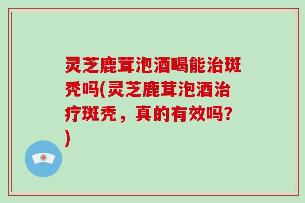 灵芝鹿茸泡酒喝能治斑秃吗(灵芝鹿茸泡酒治疗斑秃，真的有效吗？)-第1张图片-破壁灵芝孢子粉研究指南