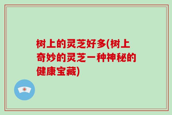 树上的灵芝好多(树上奇妙的灵芝一种神秘的健康宝藏)-第1张图片-破壁灵芝孢子粉研究指南 树上的灵芝好多(树上奇妙的灵芝一种神秘的健康宝藏)-第1张图片-破壁灵芝孢子粉研究指南